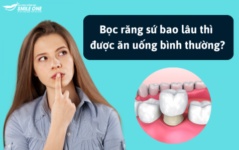 Bọc răng sứ bao lâu thì được ăn uống bình thường?